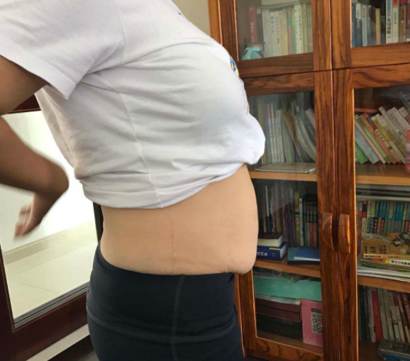 大肚腩怎么样减掉  教你活肠运动达到收腹效果