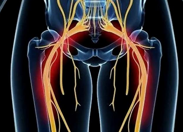 坐骨神经痛会引起什么症状 坐骨神经痛压痛点多在什么部位
