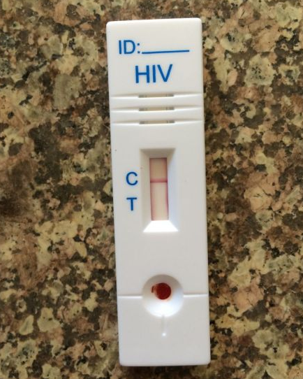 艾滋病检测试纸要多少钱 疾控中心检查艾滋病的费用标准