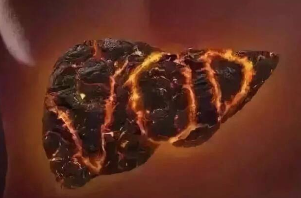 肝火旺怎么调理