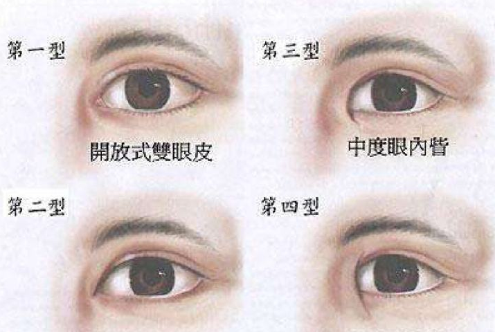 做双眼皮的危害