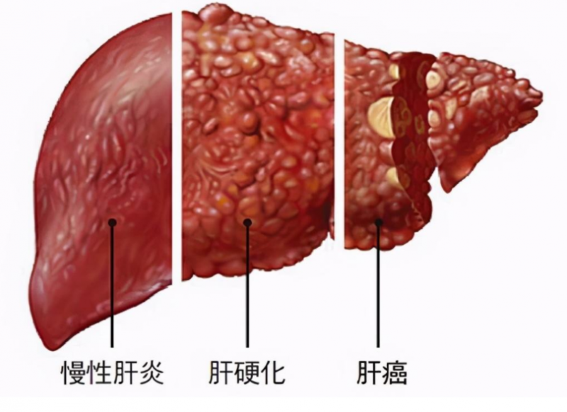 趁着还没过季，赶紧用它来养肝