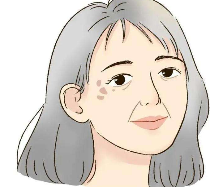如何去黄褐斑 中医祛黄褐斑食疗偏方