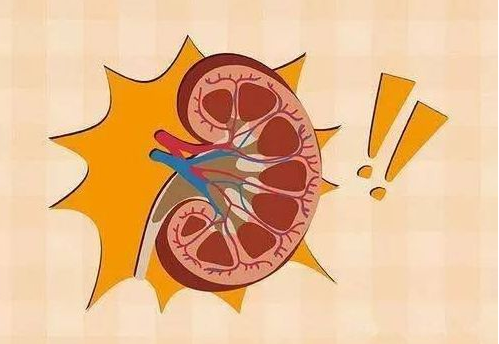肾结石 只喝饮料不喝水会导致肾结石