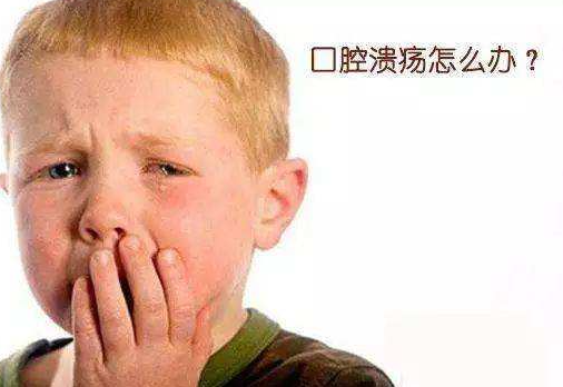 宝宝口腔溃疡怎么办