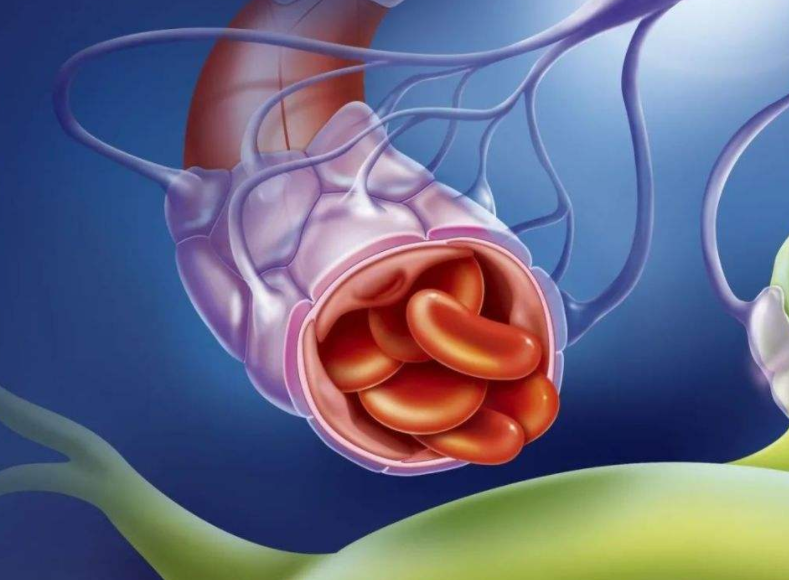 多发性腔梗吃什么药好