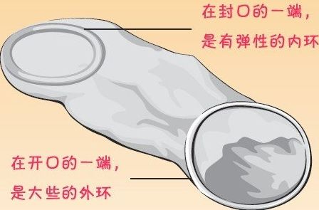 真人演示“女用避孕套”使用方法（组图）
