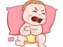 湿疹止痒妙招，湿疹怎么引起的？答案都在这！