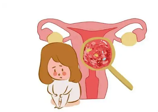 宫颈糜烂患者能游泳吗 不建议游泳或坐浴