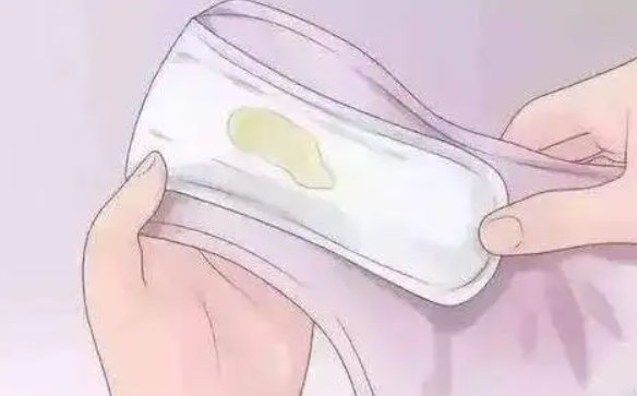 白带量较多正常吗 教你从阴道分泌物识健康