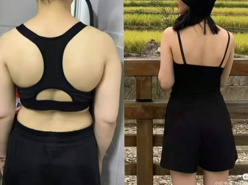背部脂肪怎么减 推荐3个小动作改善厚背的情况
