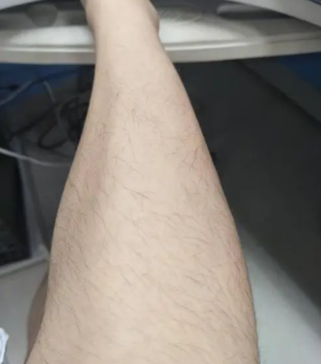 腿毛如何变细变软 腿毛吃什么才会消失