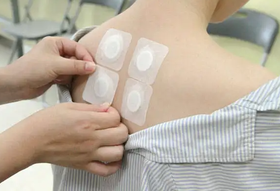 女人贴三伏贴有什么好处 三伏贴艾灸贴哪里