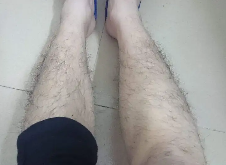 14岁怎么让腿毛消失 脱毛会越刮越粗吗