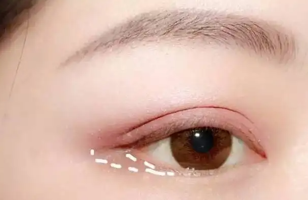 怎么防止眼睛哭肿 为什么哭完眼睛会肿