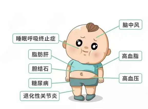 儿童肥胖怎么预防 专家提醒有时需要让孩子饿下