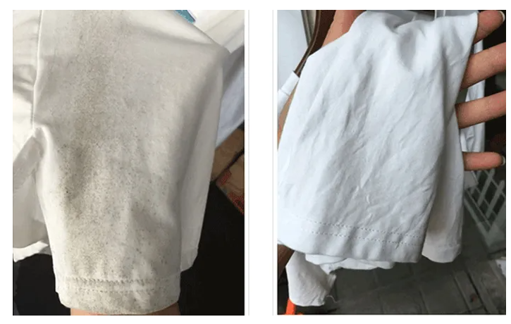 衣服什么情况下会发霉 为什么有的衣服发霉有的没有