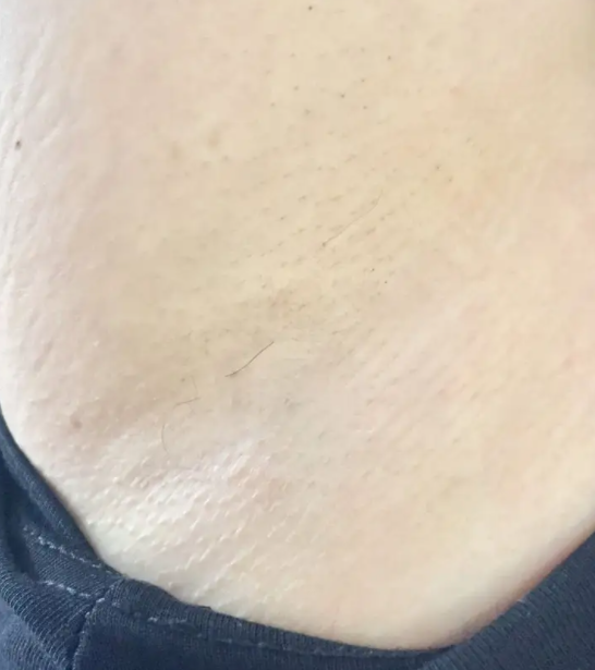 腋毛用镊子拔还会长吗 腋毛越刮越多是真的吗