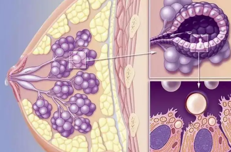 夏枯草可以治乳腺增生吗   用好夏枯草让你远离乳房疾病