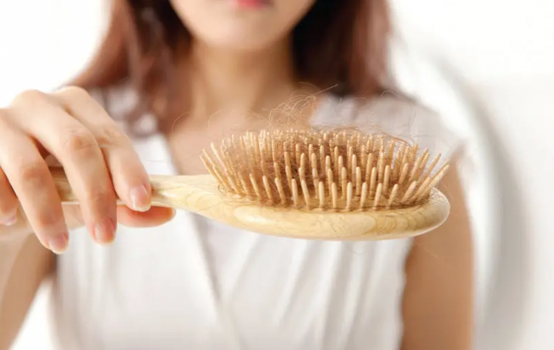 女性脂溢性脱发有哪些治疗方法 早秃治疗药物大总结
