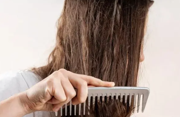 女性脂溢性脱发有哪些治疗方法 4种方法告别脱发困扰