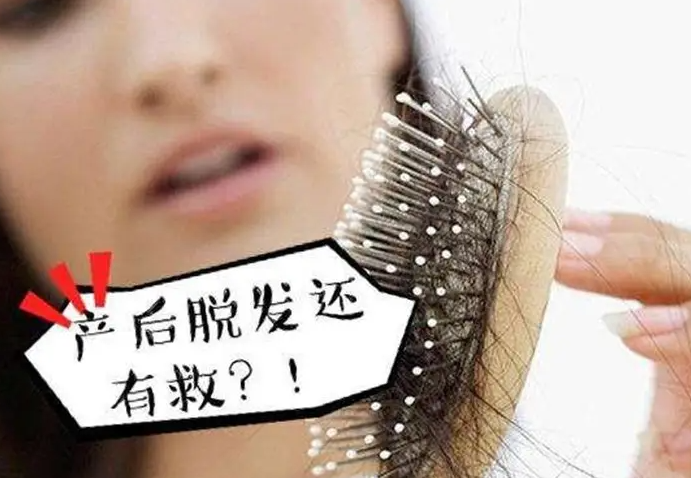 孕妇产后脱发的原因有哪些 3大原因导致你大把掉头发