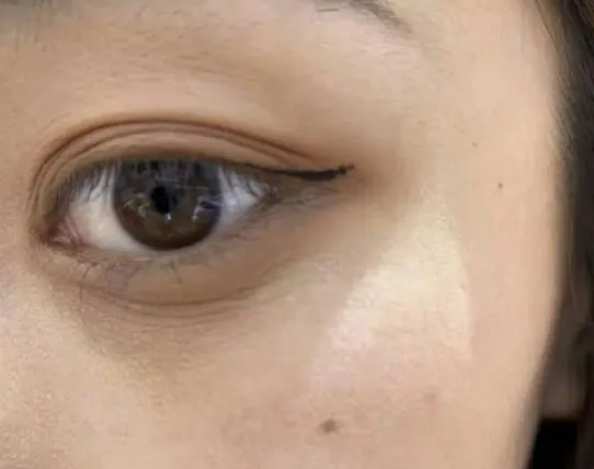 眼睛下面有细纹怎么去除 眼睛下的细纹如何消除