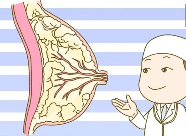 乳腺增生的症状有哪些 乳腺增生的三大症状表现