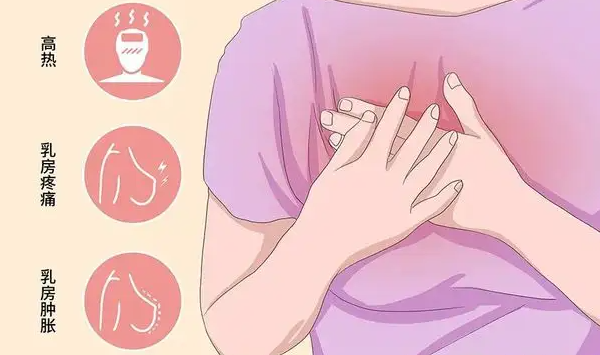 如何自我按摩治疗乳腺炎 分享四个自我按摩妙招
