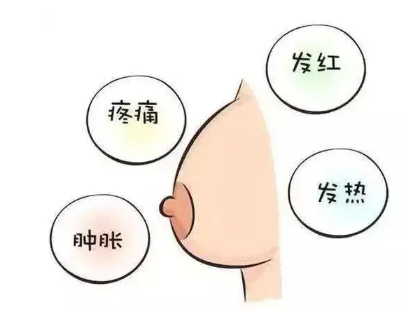 乳腺炎不能吃什么 三类食物要忌口