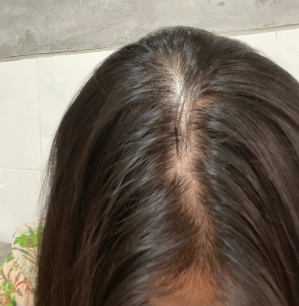 如何预防产后脱发 保持好心情