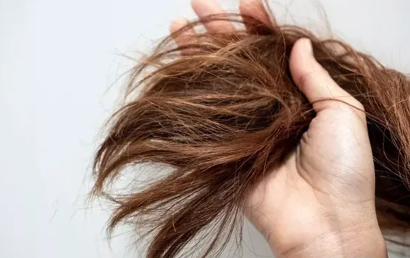 女性脱发如何护理 3大护理方法还你秀发
