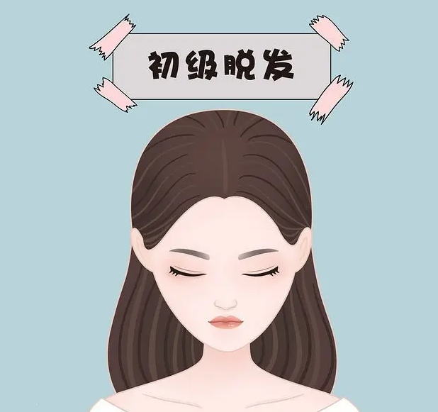 女性脱发治疗的方法有哪些 4种方法治疗效果好