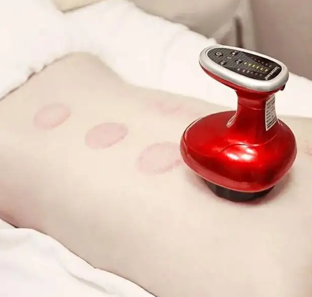 走罐是什么意思 走罐的原理