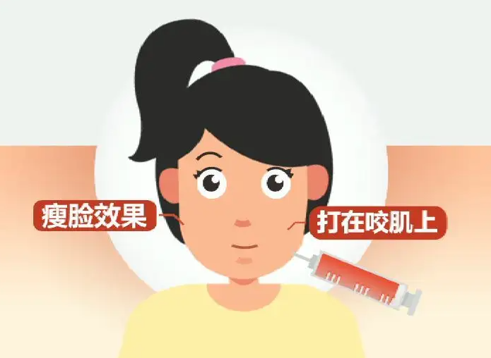 瘦脸针是永久性效果吗 瘦脸针能坚持多久