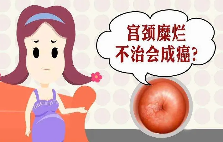 轻度宫颈糜烂能同房吗 介绍同房的注意事项