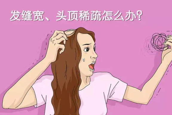 女性脂溢性脱发的危害 女性要警惕脱发2大伤害