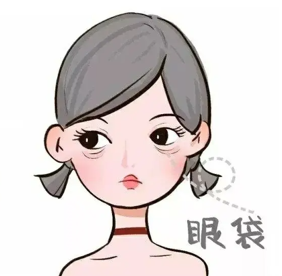 如何消除眼袋 五招帮你摆脱眼袋