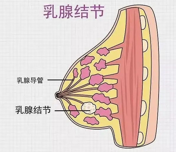 得了乳腺结节怎么办 乳腺结节三级吃什么好