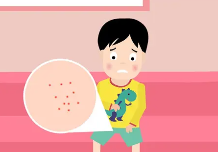 尖锐湿疣是什么样的？尖锐湿疣传染吗？
