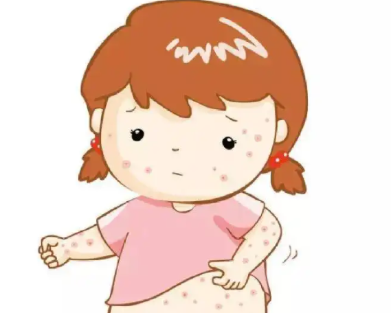 湿疹多发于婴儿的原因有哪些