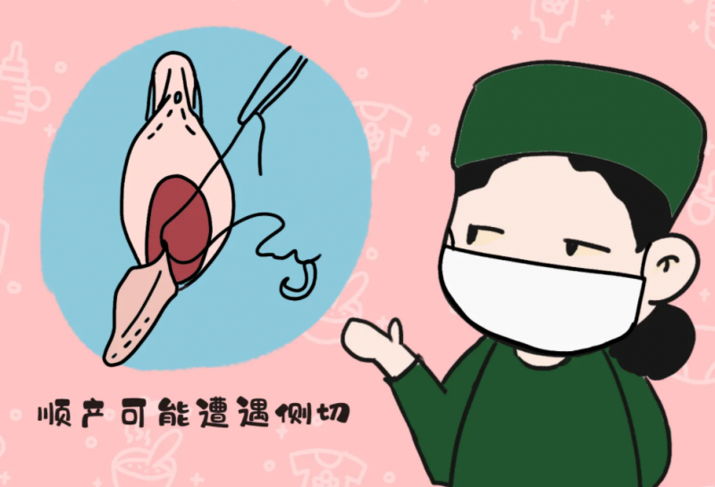 顺产妈妈必知的会阴侧切术