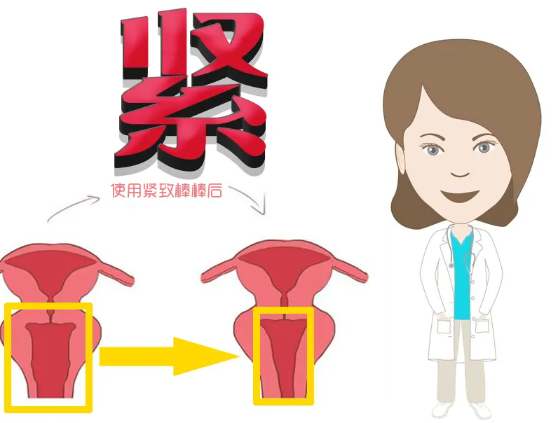什么缩阴产品最好最快，99的女人都想知道