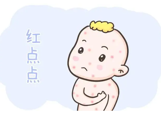 湿疹传染吗