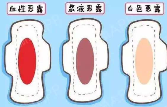 产后恶露的颜色变化过程的三个阶段