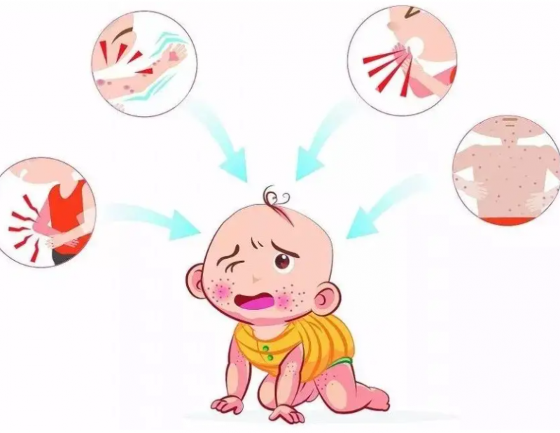 宝宝脸上湿疹怎么办，湿疹是怎么引起的