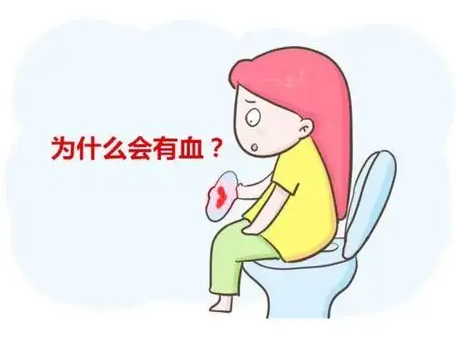 治痔瘡有什麼特效藥嗎痔瘡肉球用什麼藥效果好