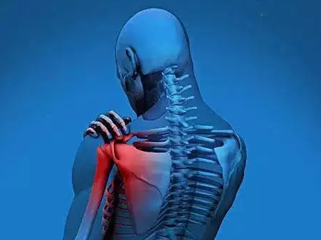 白领患有肩周炎吃什么好
