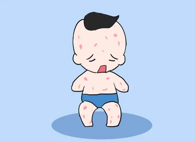 湿疹怎么才能根除