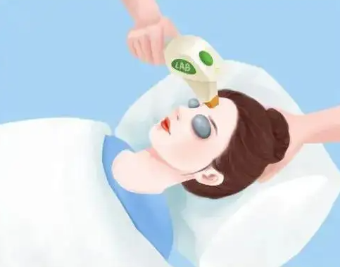 光子嫩肤的作用